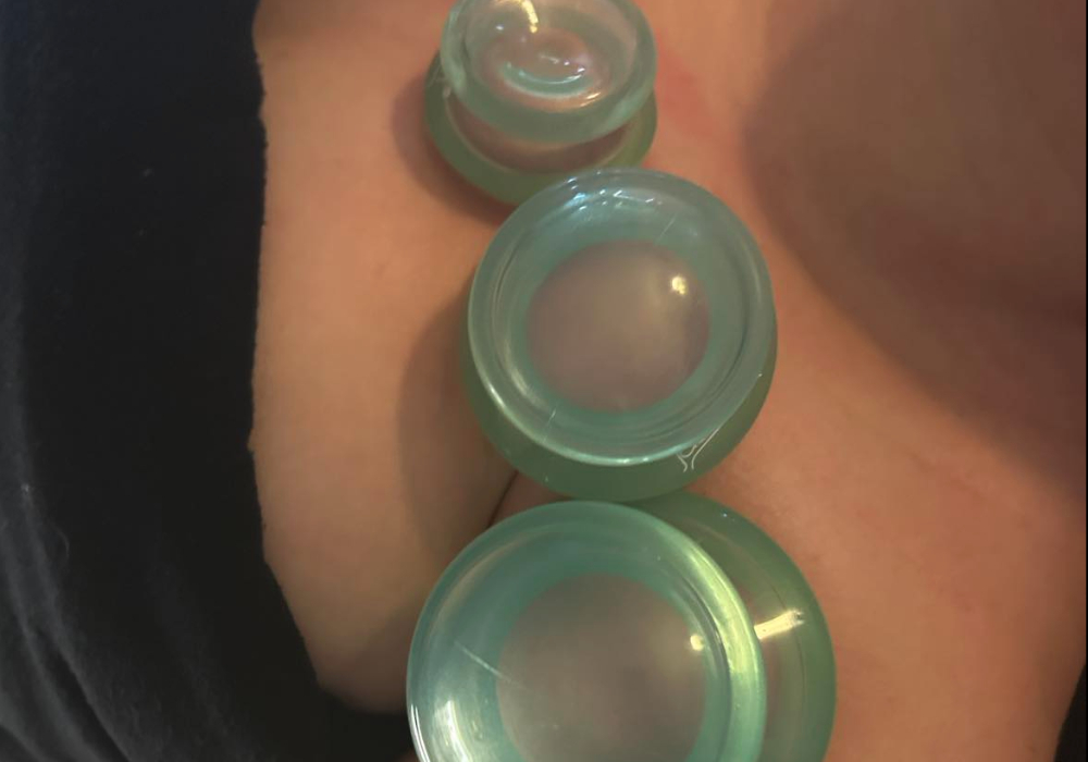 Ventouses et Gua Sha (VGS-324)